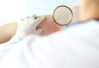 clinical trial data on inflammatory skin disease treatment