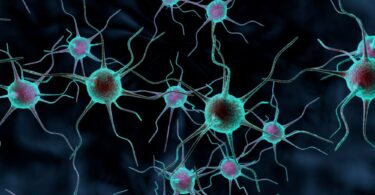 neuron synapse and amyloid plaque