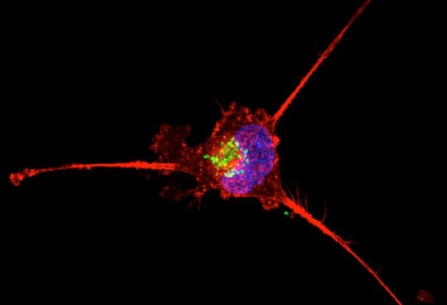 AI angiography systems for liver cancer embolization shown in cancer cell imaging