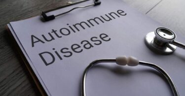 Roche lupus treatment Gazyva autoimmune disease concept clipboard