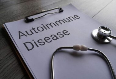 Roche lupus treatment Gazyva autoimmune disease concept clipboard