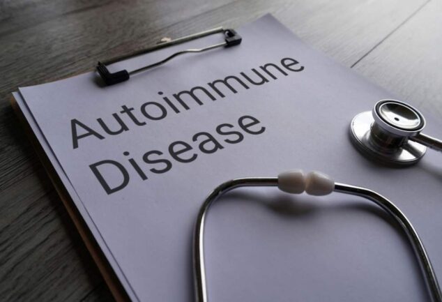Roche lupus treatment Gazyva autoimmune disease concept clipboard